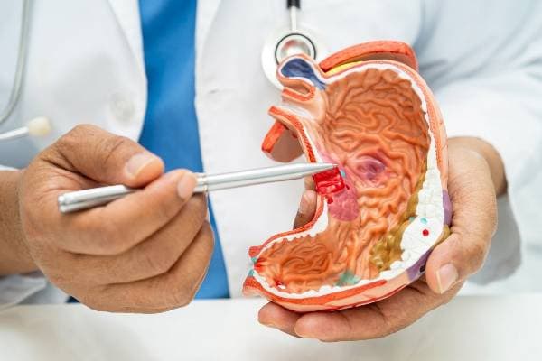 Enfermedades Gastrointestinales