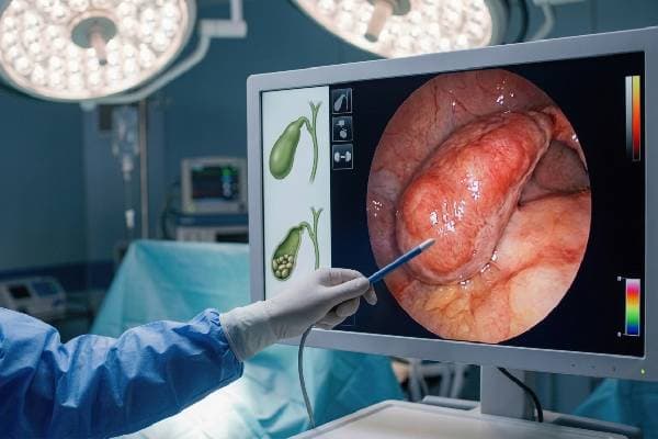 Endoscopía